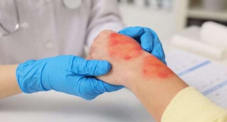 Acesso Biologics – Amniotic Tissue Products